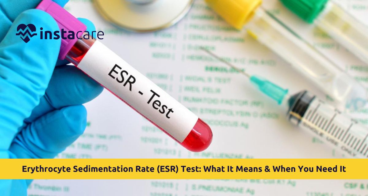 Erythrocyte Sedimentation Rate