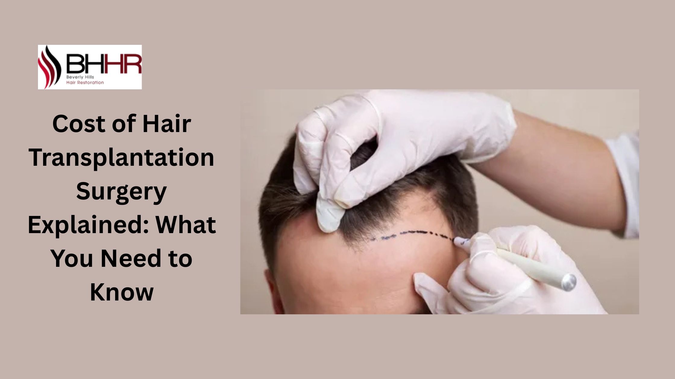 cost of hair transplantation surgery