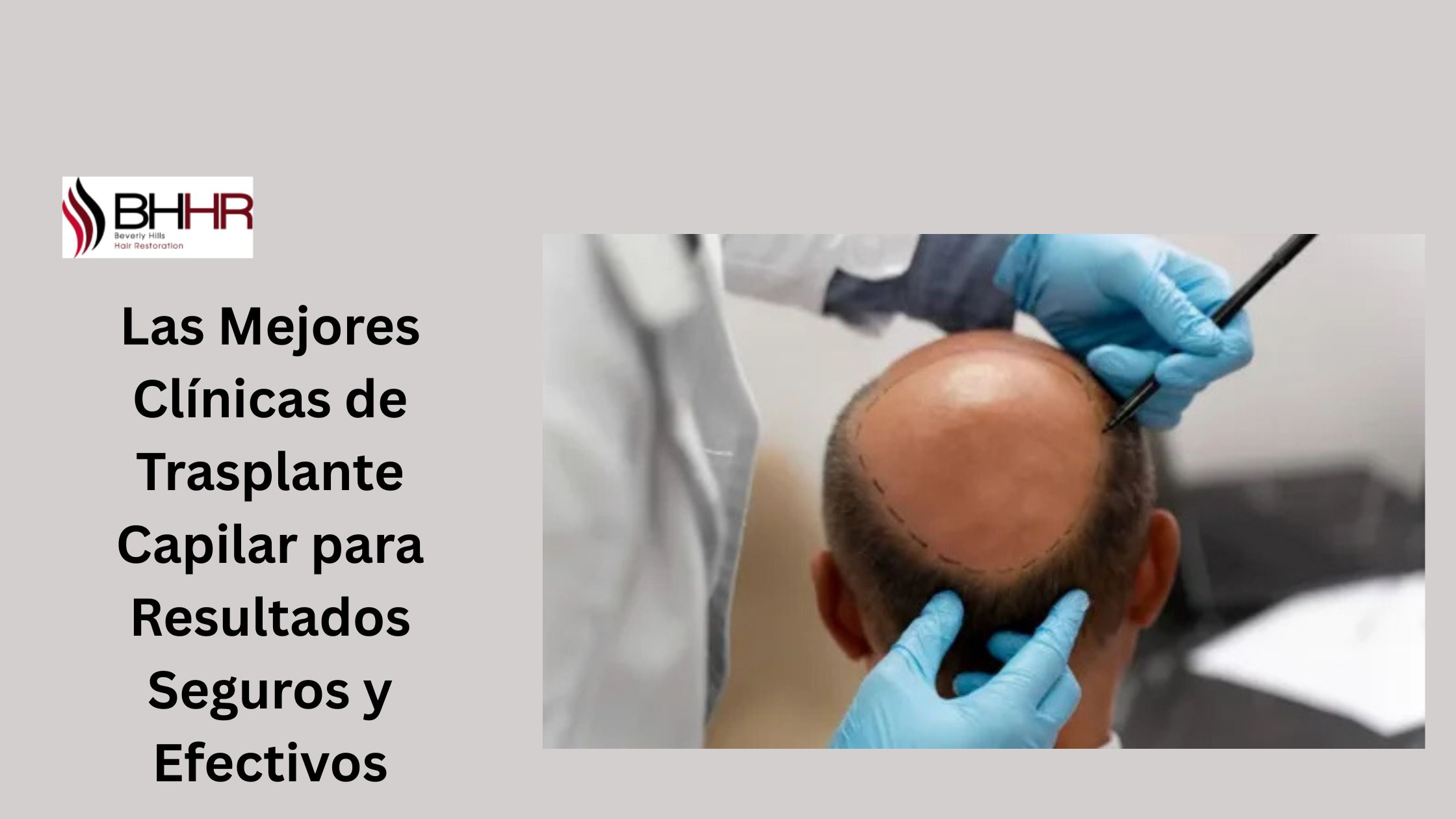 clinicas de implante capilar