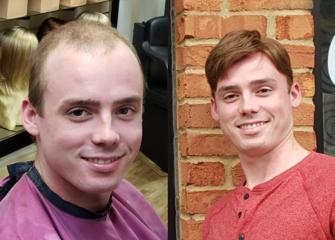 Natural, Seamless Confidence: Expert Solutions for Men’s Hair Pieces ...