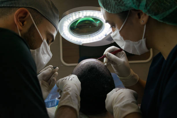 Hair Transplant in Riyadh