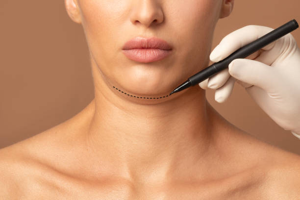 Double Chin Removal in Abu Dhabi
